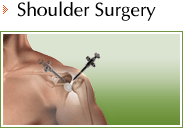 Shoulder - Daniel F Craviotto Jr MD - Orthopaedic Surgery